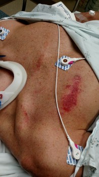 IMG_20170902_160926504